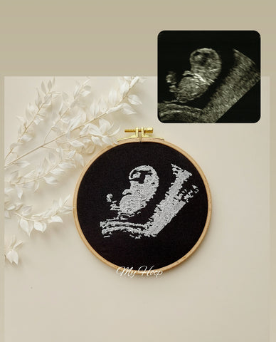 Stickbild Ultraschallbild - ultrasound - Ultraschallstickbild - ø16cm